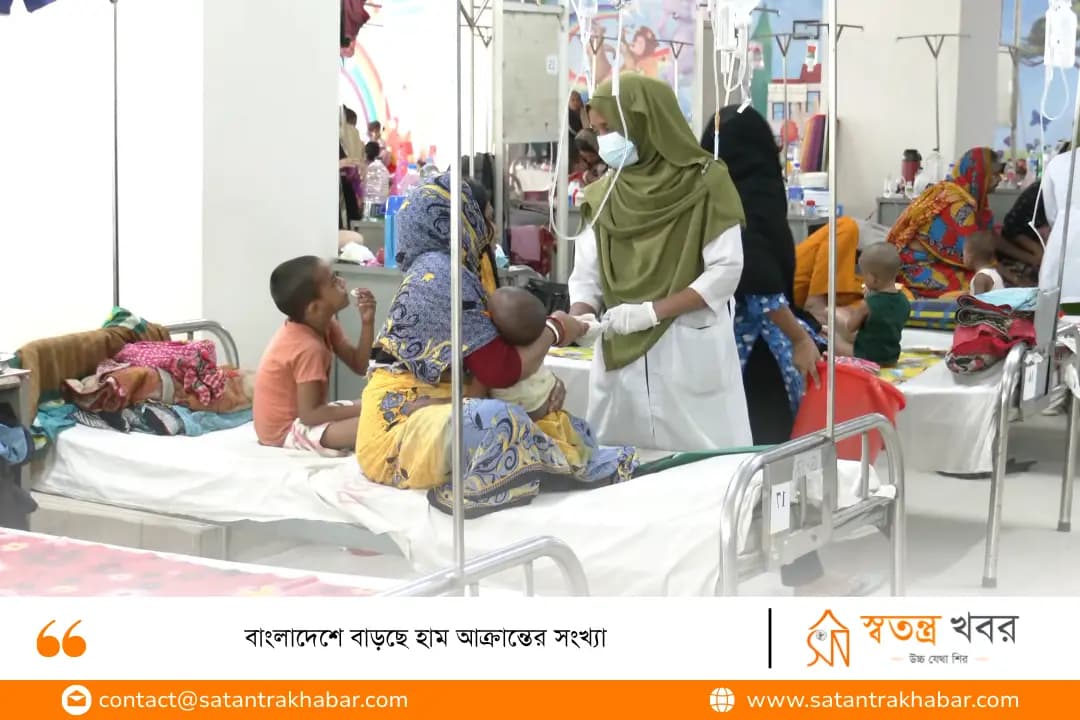 বাংলাদেশে বাড়ছে হাম আক্রান্তের সংখ্যা