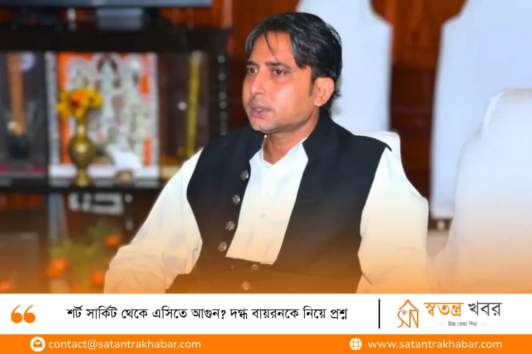 শর্ট সার্কিট থেকে এসিতে আগুন? দগ্ধ বায়রনকে নিয়ে প্রশ্ন